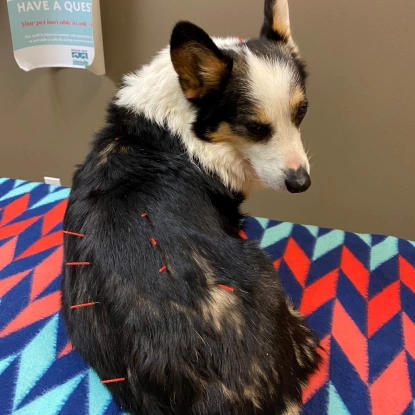 Acupuncture